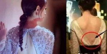 女明星拍戏受伤,女明星拍戏意外受伤，敬业精神引关注